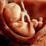 ultrasonografia płód